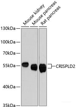 Western blot analysis of extracts of various cell lines using RPL14 Polyclonal Antibody at dilution of 1:1000.