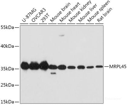 Immunohistochemistry of paraffin-embedded Human liver cancer using NFS1 Polyclonal Antibody at dilution of 1:100 (40x lens).