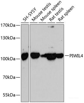 Immunofluorescence analysis of U2OS cells using TGM5 Polyclonal Antibody