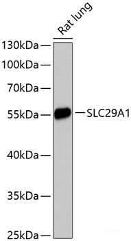 Immunohistochemistry of paraffin-embedded Human liver damage using DPP3 Polyclonal Antibody at dilution of 1:100 (40x lens).