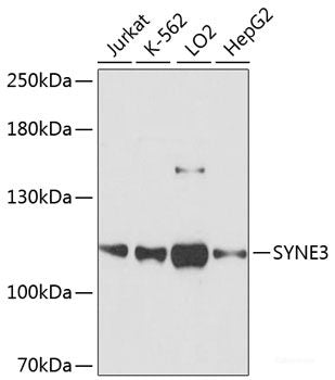 Immunofluorescence analysis of U2OS cells using TARDBP Polyclonal Antibody at dilution of 1:100. Blue: DAPI for nuclear staining.