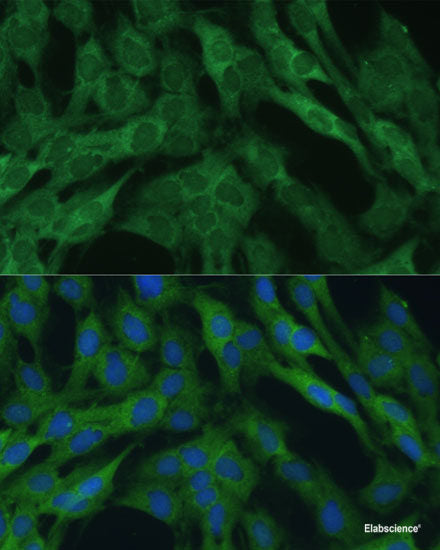 Immunofluorescence analysis of A549 cells using POC1A Polyclonal Antibody