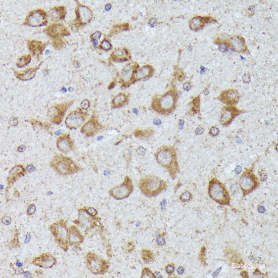 Immunofluorescence analysis of A549 cells using LHX6 Polyclonal Antibody
