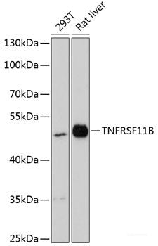 Immunohistochemistry of paraffin-embedded Rat brain using PELP1 Polyclonal Antibody at dilution of 1:100 (40x lens).