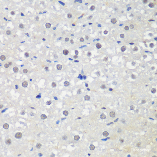 Immunofluorescence analysis of A549 cells using IP6K2 Polyclonal Antibody