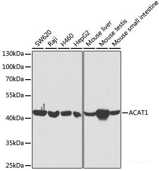 Immunofluorescence analysis of A549 cells using NAT8B Polyclonal Antibody