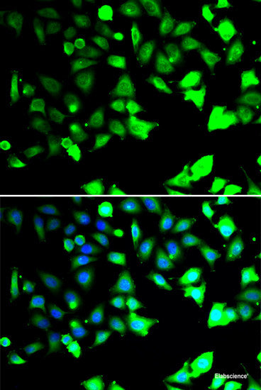 Western blot analysis of extracts of various cell lines using Cytochrome c Polyclonal Antibody at dilution of 1:1000.