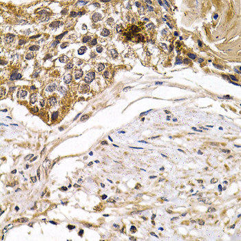 Immunofluorescence analysis of MCF-7 cells using DIABLO Polyclonal Antibody