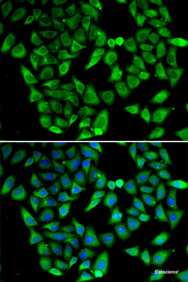 Western blot analysis of extracts of Mouse kidney using C10orf2 Polyclonal Antibody at dilution of 1:1000.