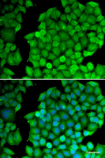 Immunofluorescence analysis of U2OS cells using RAD18 Polyclonal Antibody