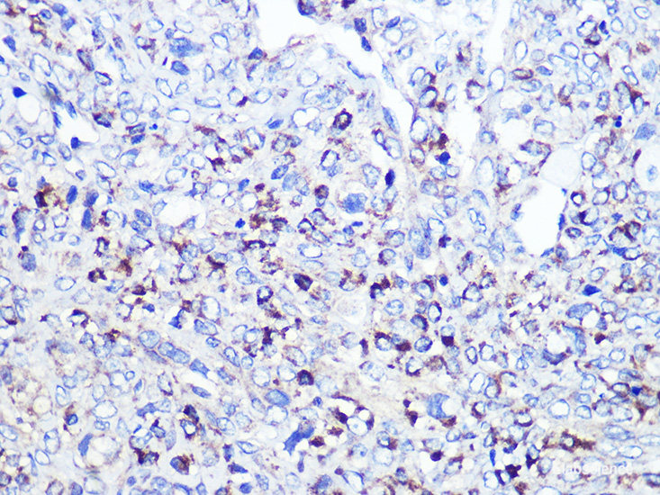 Immunohistochemistry of paraffin-embedded Human kidney using GOPC Polyclonal Antibody at dilution of 1:100 (40x lens).