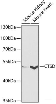 Immunofluorescence analysis of Hela cells using TIM-3/HAVCR2 Polyclonal Antibody at dilution of 1:100 (40x lens). Blue: DAPI for nuclear staining.