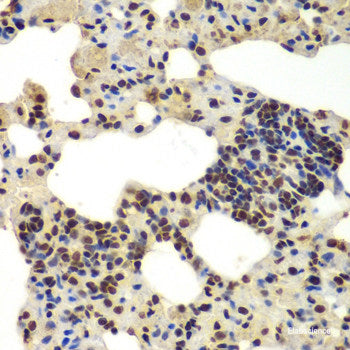 Immunofluorescence analysis of A549 cells using TTBK2 Polyclonal Antibody
