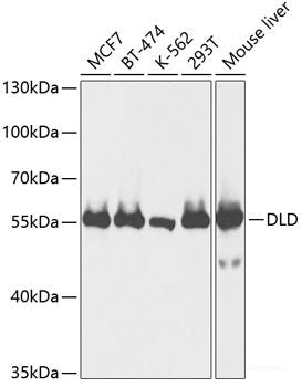 Immunohistochemistry of paraffin-embedded Human tonsil using MLKL Polyclonal Antibody at dilution of 1:100 (40x lens).