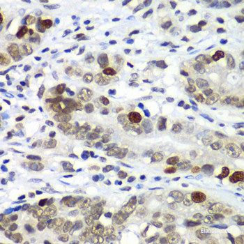 Immunofluorescence analysis of MCF-7 cells using NSUN6 Polyclonal Antibody