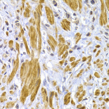 Immunofluorescence analysis of HeLa cells using LHX8 Polyclonal Antibody