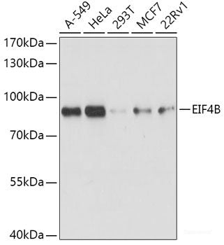 Immunohistochemistry of paraffin-embedded Human prostate using ACPP Polyclonal Antibody at dilution of 1:100 (40x lens).