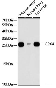 Western blot analysis of extracts of various cell lines using AK4 Polyclonal Antibody at dilution of 1:1000.