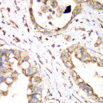 Immunofluorescence analysis of HeLa cells using ALAS1 Polyclonal Antibody