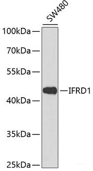 Immunofluorescence analysis of HeLa cells using APEH Polyclonal Antibody