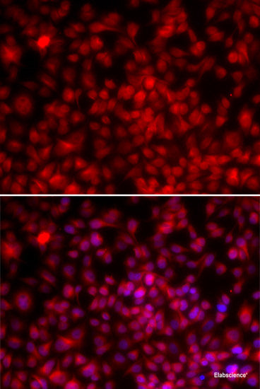 Immunofluorescence analysis of U-2 OS cells using ATF3 Polyclonal Antibody at dilution of 1:100. Blue: DAPI for nuclear staining.