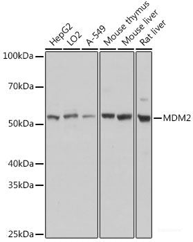 Western blot analysis of extracts of Mouse liver using CD1D Polyclonal Antibody at dilution of 1:1000.