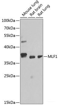 Immunofluorescence analysis of HeLa cells using CHD2 Polyclonal Antibody