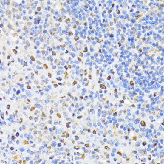 Immunohistochemistry of paraffin-embedded Rat lung using CSNK2A2 Polyclonal Antibody at dilution of 1:100 (40x lens).