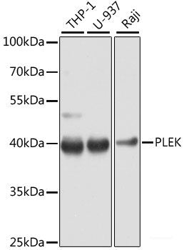 Immunohistochemistry of paraffin-embedded Human mammary gland using CTSS Polyclonal Antibody at dilution of 1:200 (40x lens).