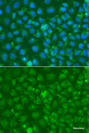 Western blot analysis of extracts of Mouse testis using CYP51A1 Polyclonal Antibody at dilution of 1:1000.
