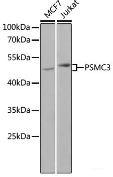 Immunofluorescence analysis of A549 cells using FABP6 Polyclonal Antibody