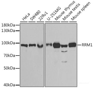 Immunofluorescence analysis of HeLa cells using GJA5 Polyclonal Antibody