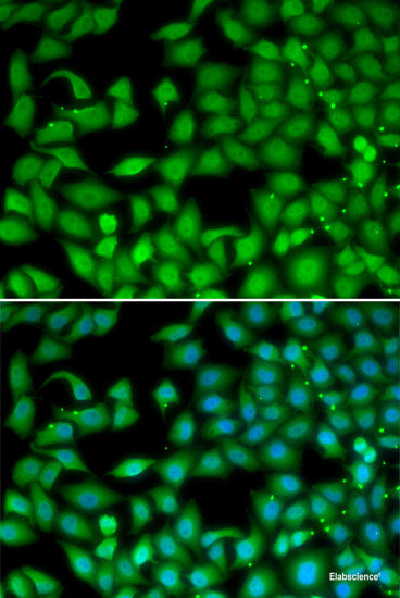 Immunohistochemistry of paraffin-embedded Mouse lung using GSS Polyclonal Antibody at dilution of 1:200 (40x lens).
