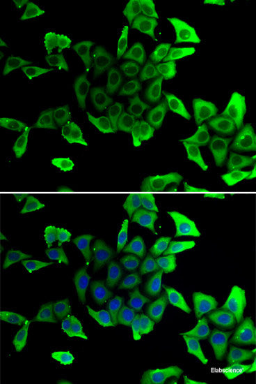 Western blot analysis of extracts of various cell lines using GTF2F2 Polyclonal Antibody at dilution of 1:1000.