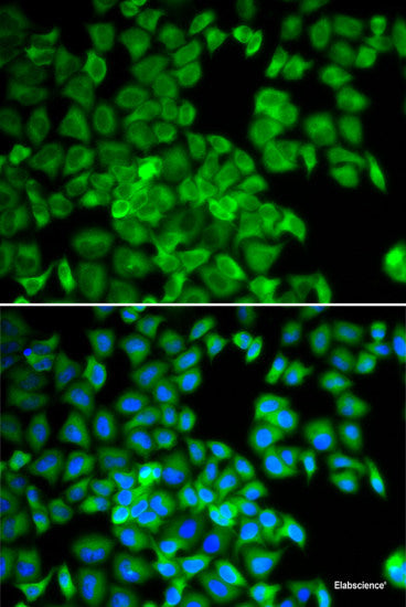 Immunohistochemistry of paraffin-embedded Human esophagus using IL7R Polyclonal Antibody at dilution of 1:100 (40x lens).