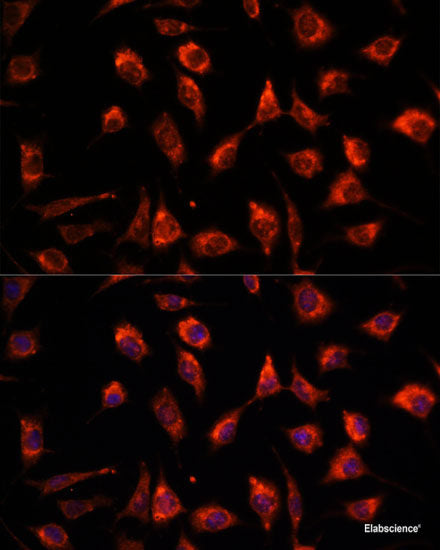 Immunofluorescence analysis of HeLa cells using LCP2 Polyclonal Antibody