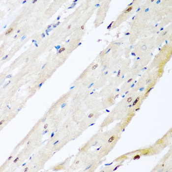 Western blot analysis of extracts of various cell lines using LIG3 Polyclonal Antibody at dilution of 1:1000.