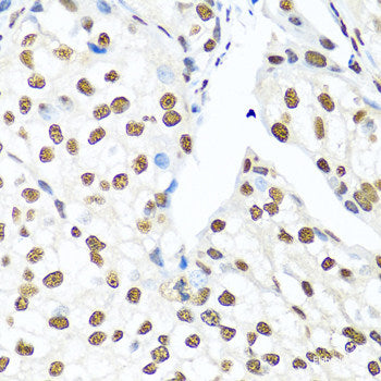 Immunofluorescence analysis of A549 cells using LIPC Polyclonal Antibody