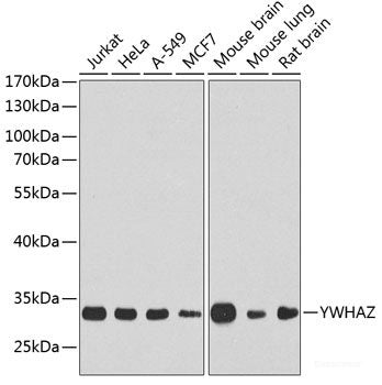 Immunohistochemistry of paraffin-embedded Human tonsil using CD44 Polyclonal Antibody at dilution of 1:200 (40x lens).