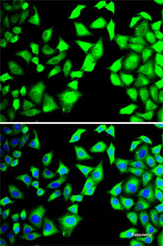 Western blot analysis of extracts of HT-29 cells using CD46 Polyclonal Antibody at dilution of 1:1000.