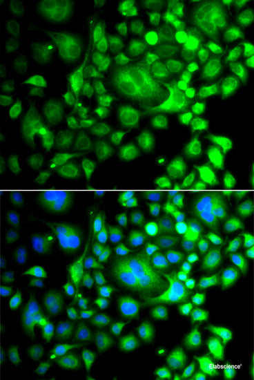 Western blot analysis of extracts of Mouse thymus using MTM1 Polyclonal Antibody at dilution of 1:1000.