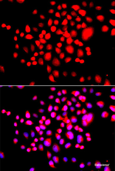 Immunohistochemistry of paraffin-embedded Mouse spleen using NOTCH3 Polyclonal Antibody at dilution of 1:100 (40x lens).