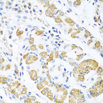 Immunohistochemistry of paraffin-embedded Human colon using PSMA4 Polyclonal Antibody at dilution of 1:100 (40x lens).