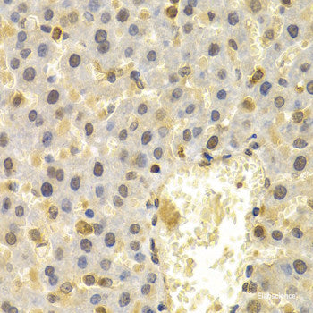 Immunohistochemistry of paraffin-embedded Rat testis using PVALB Polyclonal Antibody at dilution of 1:100 (40x lens).