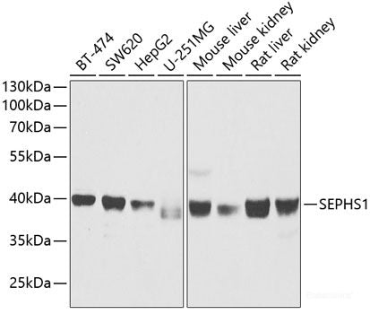 Immunofluorescence analysis of MCF-7 cells using RPL11 Polyclonal Antibody