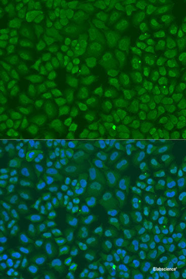 Western blot analysis of extracts of various cell lines using RPS3 Polyclonal Antibody at dilution of 1:1000.