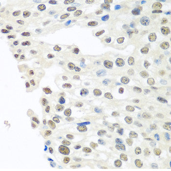 Western blot analysis of extracts of various cell lines using ST3GAL4 Polyclonal Antibody at dilution of 1:1000.