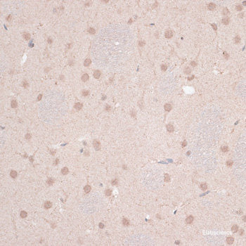 Immunofluorescence analysis of HeLa cells using SPINK1 Polyclonal Antibody