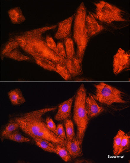Immunohistochemistry of paraffin-embedded Mouse liver using ST14 Polyclonal Antibody at dilution of 1:200 (40x lens).