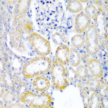 Immunofluorescence analysis of U2OS cells using TSPAN7 Polyclonal Antibody